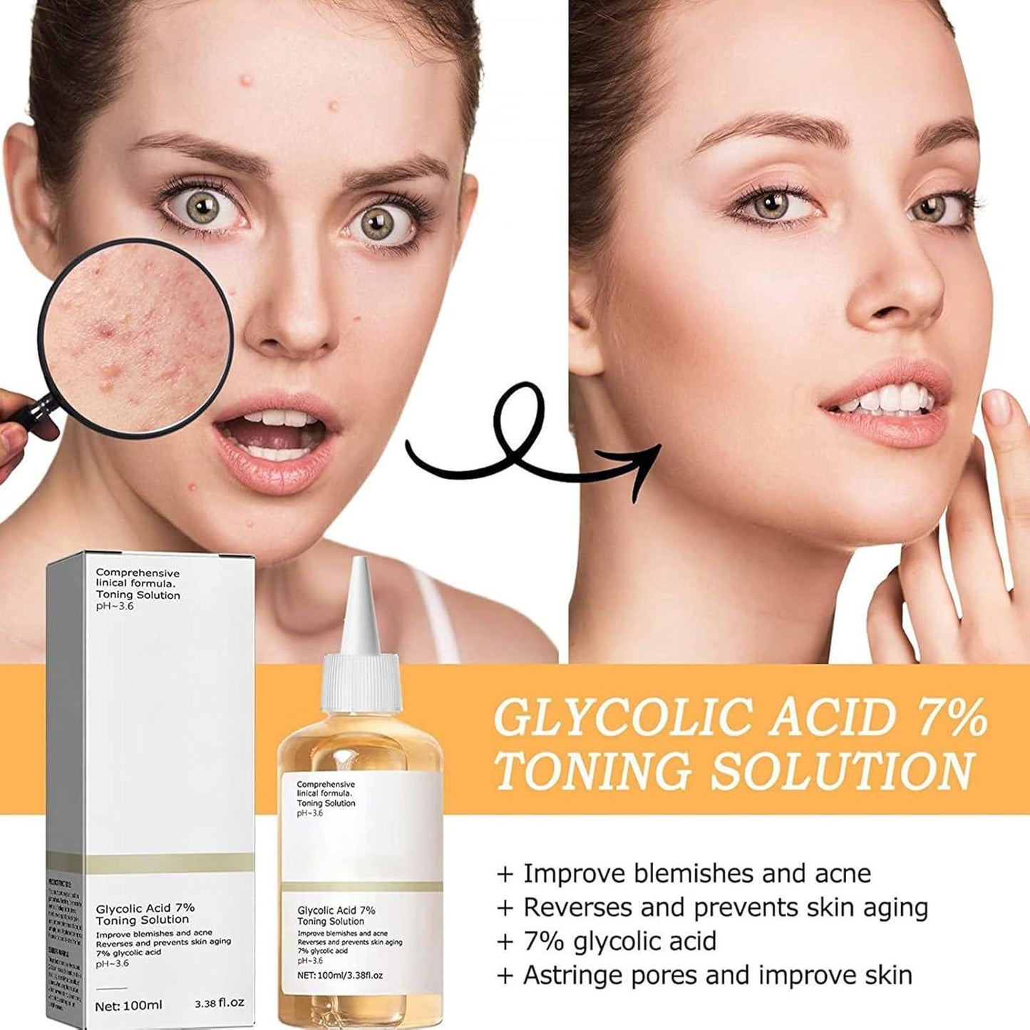 Glycolic Acid 7% Toner – 100ml